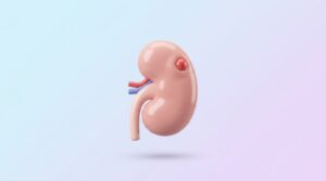 신장암, 침묵의 암 극복을 위한 조기 진단과 치료